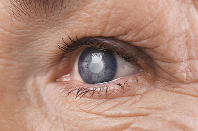 Eye to Eye | Pediatric Eye Care, Optical Department and Eyenavision